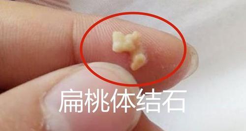 身体气味异常预示哪些疾病?从口臭汗臭看懂健康信号 身体气味异常预示哪些疾病?从口臭汗臭看懂健康信号