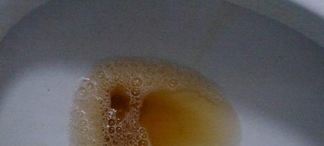 身体气味异常预示哪些疾病?从口臭汗臭看懂健康信号 身体气味异常预示哪些疾病?从口臭汗臭看懂健康信号