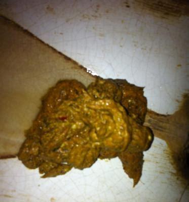 大便不成形原因与改善方法全解析，从饮食到生活习惯的调整指南