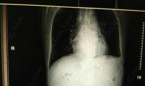 狗狗拉黑色便便怎么回事？从饮食到疾病的详细原因解析