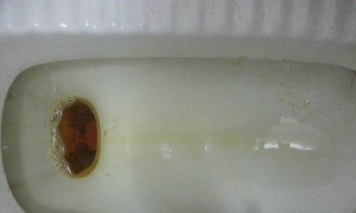 尿液变绿原因解析与健康警示,何时需要就医检查 尿液变绿原因解析与健康警示,何时需要就医检查