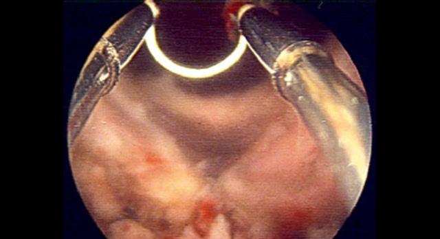 尿液变绿原因解析与健康警示,何时需要就医检查 尿液变绿原因解析与健康警示,何时需要就医检查