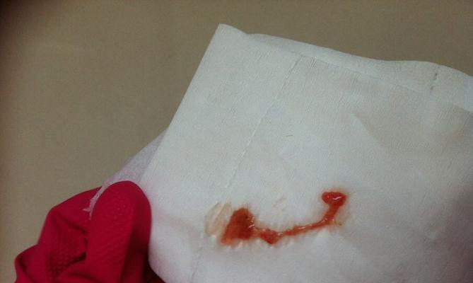 泰迪便便健康全解析：从颜色质地看消化系统问题与护理