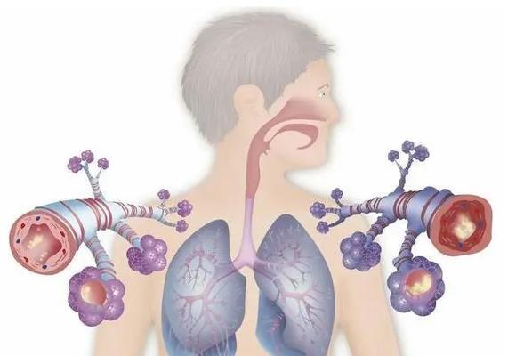 比熊犬气管炎的症状识别与综合治疗指南