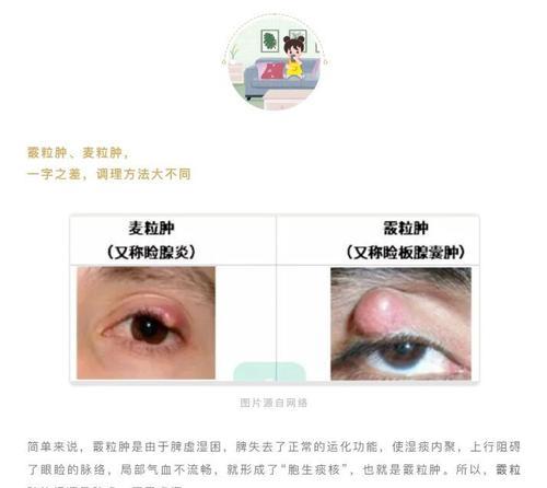 眼屎颜色揭示健康秘密:常见颜色解析与健康警示 眼屎颜色揭示健康秘密:常见颜色解析与健康警示