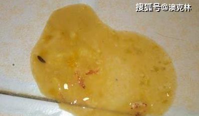 狗罐装病毒传播途径与症状详解，科学防控守护犬只健康