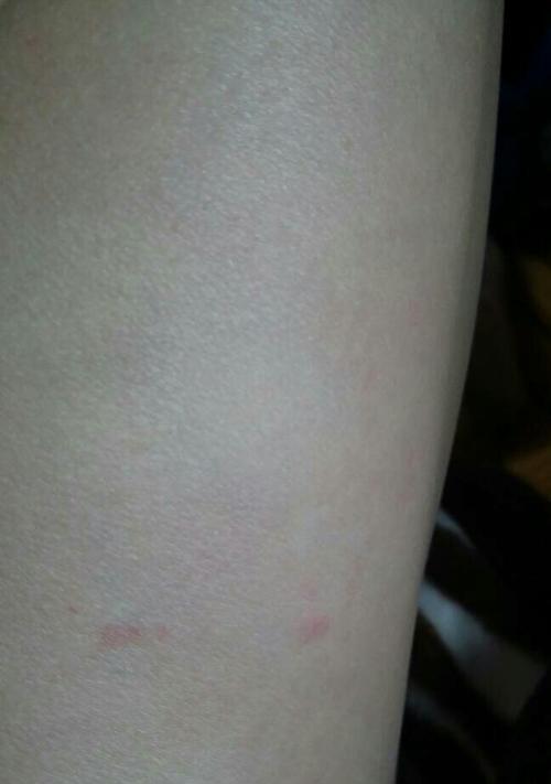 狗狗为何频繁咬腿？常见原因解析与实用应对方法