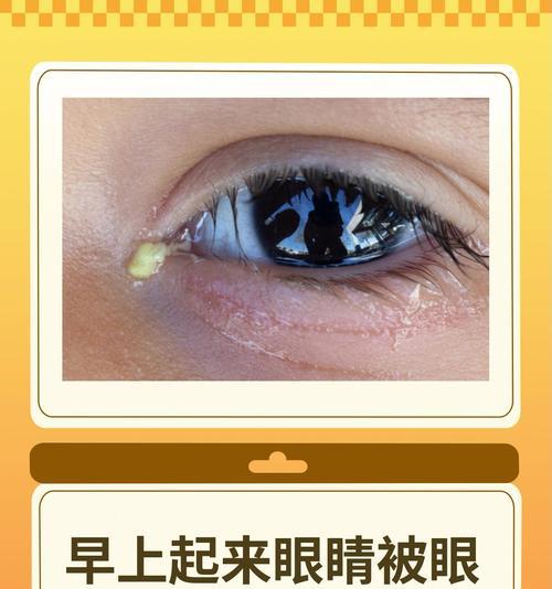 狗眼屎多是什么原因？如何用药治疗及日常护理指南