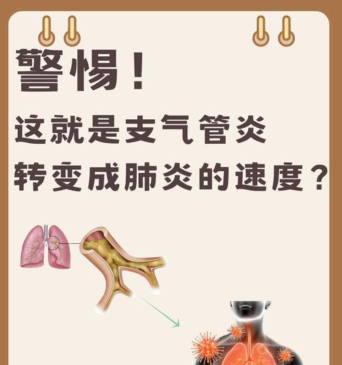 皮肤病喷剂治疗周期与效果分析,掌握正确使用方法 皮肤病喷剂治疗周期与效果分析,掌握正确使用方法