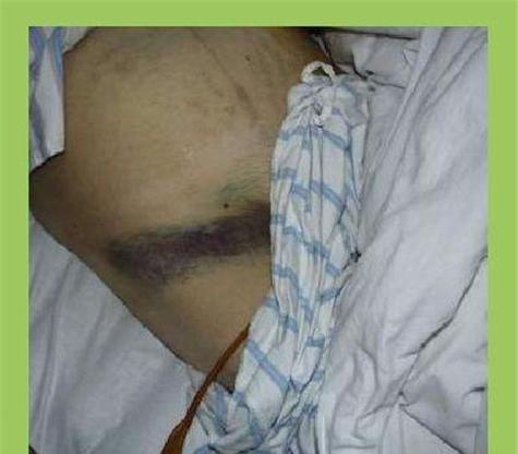 胰头炎的15个典型症状与危害解析,预防与治疗指南 胰头炎的15个典型症状与危害解析,预防与治疗指南