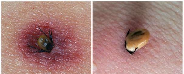 狗狗蜱虫防治全攻略：危害识别、预防措施与正确处理方法