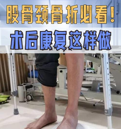 大腿骨折康复全解析:恢复阶段与注意事项 大腿骨折康复全解析:恢复阶段与注意事项