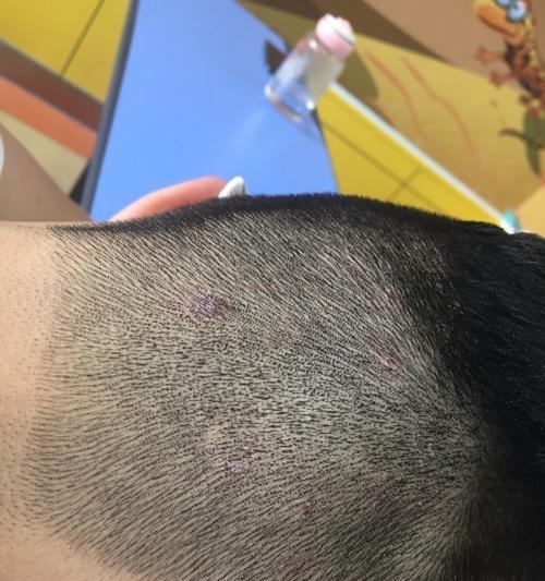 狗狗头皮屑原因及防治方法全解析