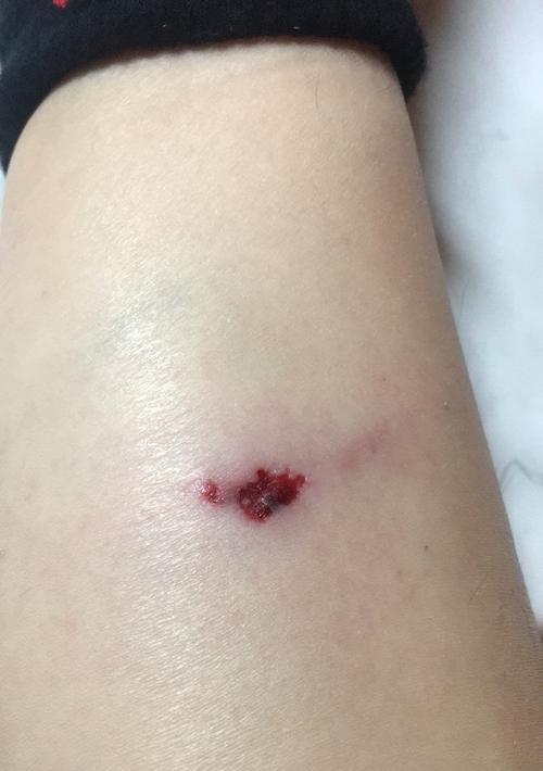 狗狗被咬破皮处理指南：家庭急救与护理要点