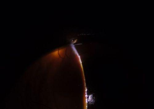 猫眼中的黑色物质解析:神秘与守护的象征 猫眼中的黑色物质解析:神秘与守护的象征