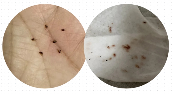 如何判断猫咪身上有没有虫? 如何判断猫咪身上有没有虫?