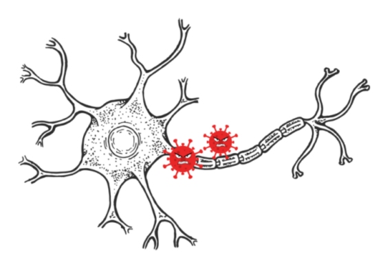 犬瘟热转阴后抽搐如何预防? 犬瘟热转阴后抽搐如何预防?