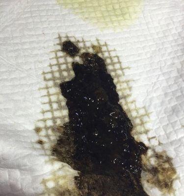 狗狗舌头三点黑色成因解析与健康指南 狗狗舌头三点黑色成因解析与健康指南