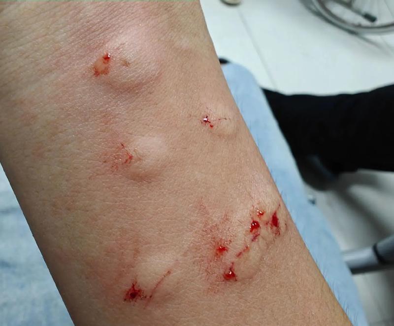 狗狗白蛋白不足症状与预防全解析 狗狗白蛋白不足症状与预防全解析