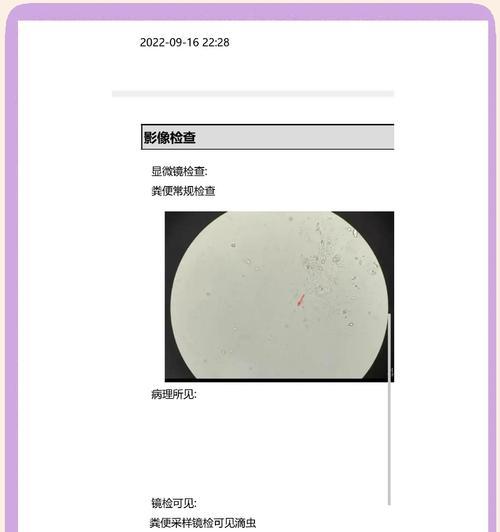 猫咪粪便检查的15个关键指标与健康意义 猫咪粪便检查的15个关键指标与健康意义