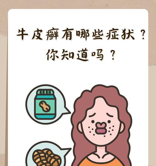 英斗皮肤病全面解析:病因症状与有效治疗方法指南 英斗皮肤病全面解析:病因症状与有效治疗方法指南