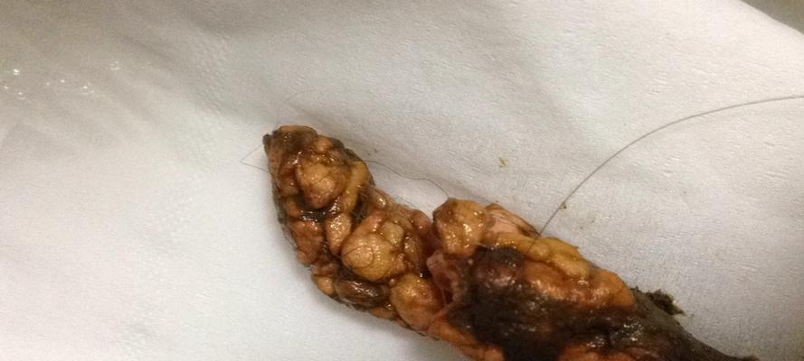 细小病毒感染第五天饮食指南：15种营养食谱推荐