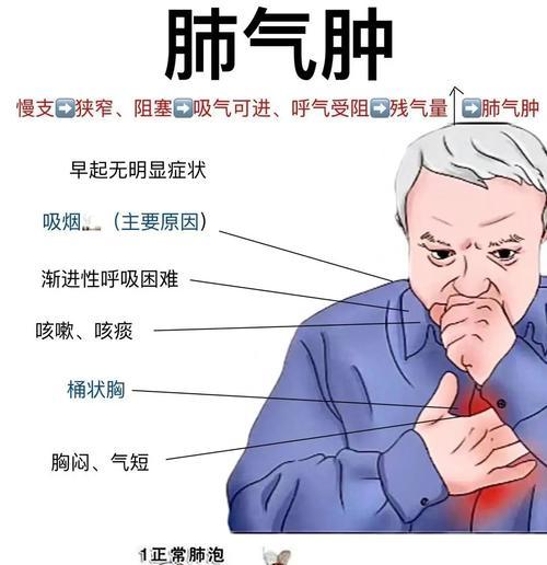 狗狗肺气肿症状诊断治疗全攻略,早期发现是关键 狗狗肺气肿症状诊断治疗全攻略,早期发现是关键
