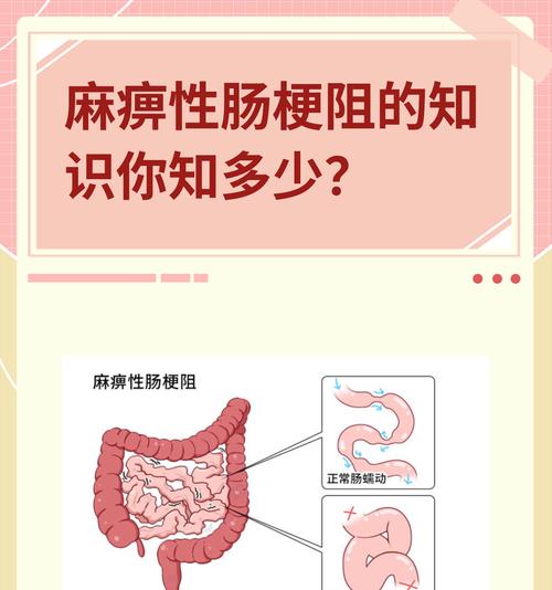 小狗肠梗阻症状及识别方法|宠物健康实用指南 小狗肠梗阻症状及识别方法|宠物健康实用指南