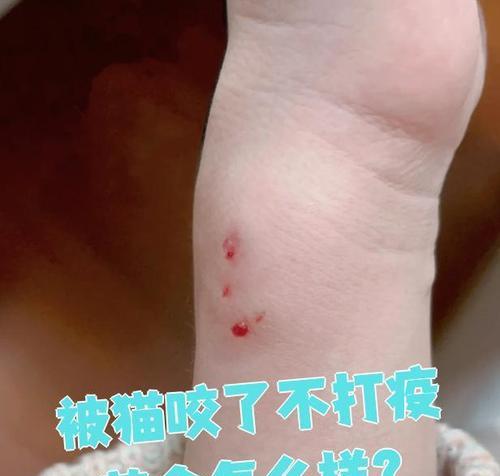 猫咪咬伤应急处理要点与医疗指南：安全护理方法