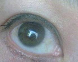 眼白混浊的常见原因与解决对策,保持眼部清澈明亮 眼白混浊的常见原因与解决对策,保持眼部清澈明亮