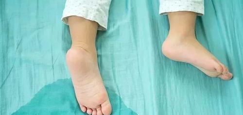 人体排泄机制解析：排便与排尿的相似点与区别详解