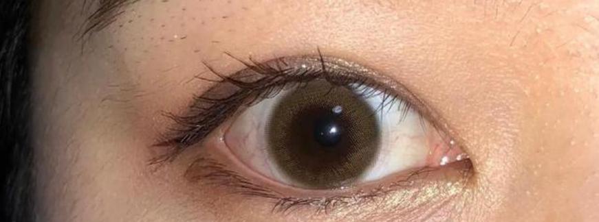 眼白混浊的常见原因与解决对策,保持眼部清澈明亮 眼白混浊的常见原因与解决对策,保持眼部清澈明亮